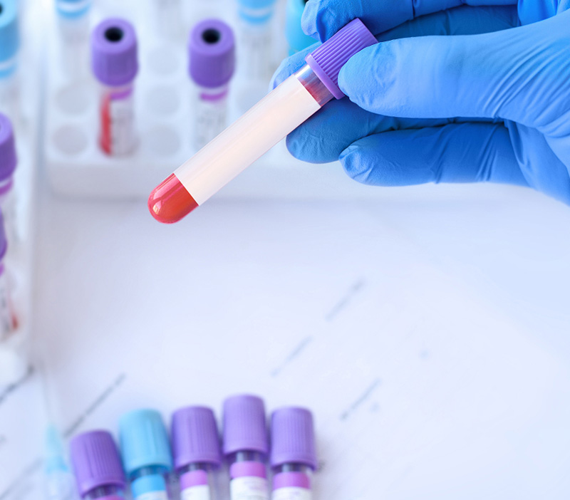 Prélèvements médicaux